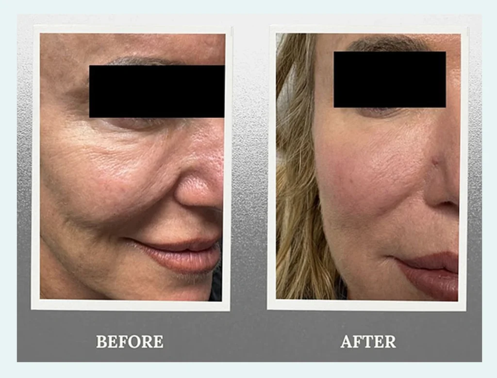 RegenHealth Utah